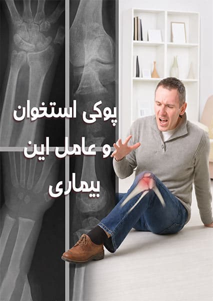علل و پیشگیری از پوکی استخوان