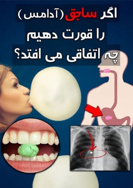 خطرات بلعیدن ساجق