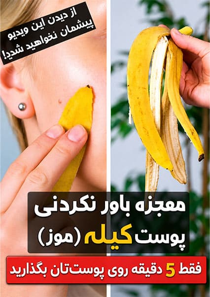 فواید شگفت‌انگیز پوست کیله