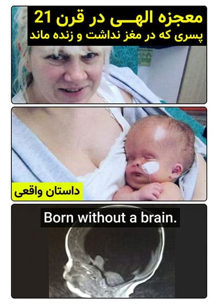 داستان عجیب پسری بدون مغز