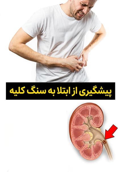 علت تشکیل سنگ کلیه