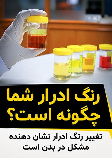 رازهای سلامتی از روی رنگ ادرار