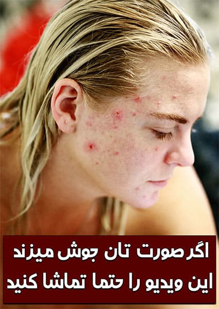 تغذیه و سلامت پوست: مواد غذایی ضد جوش